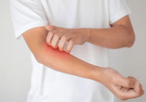 Person receiving a vaccine injection